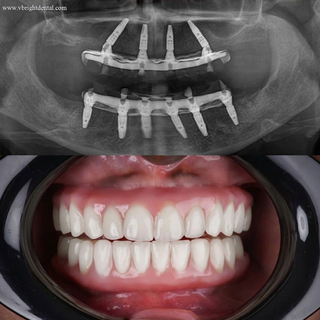 Restorative care comparison photo